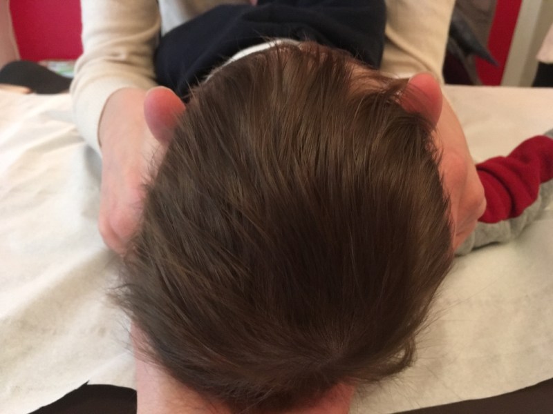 PLAGIOCEPHALIE – Le traitement : ostéopathie et&nbsp;kinésithérapie